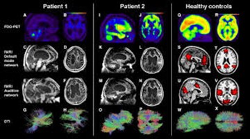 Neuroimaging data